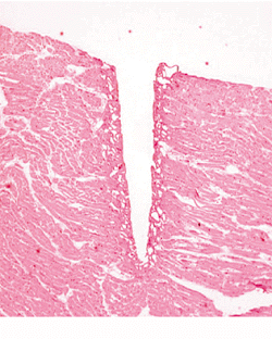 Biomaterials processing