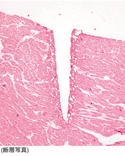 Biomaterials processing